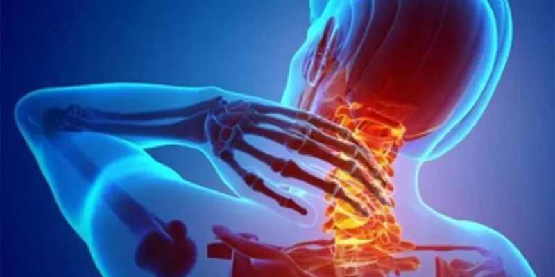 Bệnh thoát vị đĩa đệm cổ