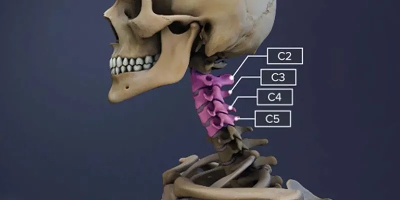 Thoát vị đĩa đệm cột sống cổ C3 C4