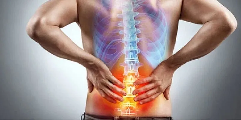 thoát vị đĩa đệm lưng