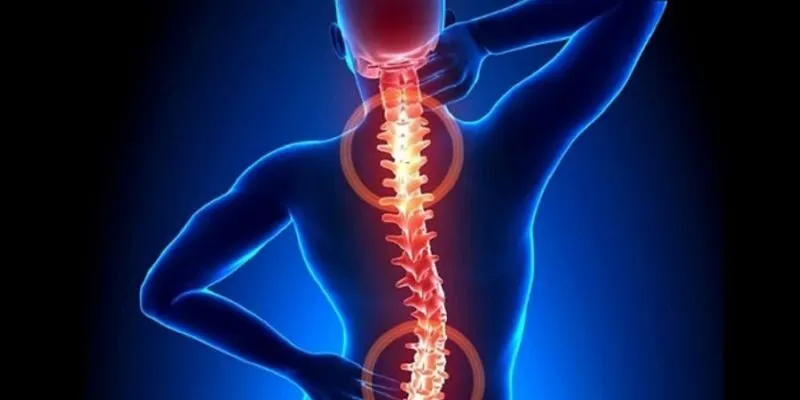 thoát vị đĩa đệm giai đoạn cuối