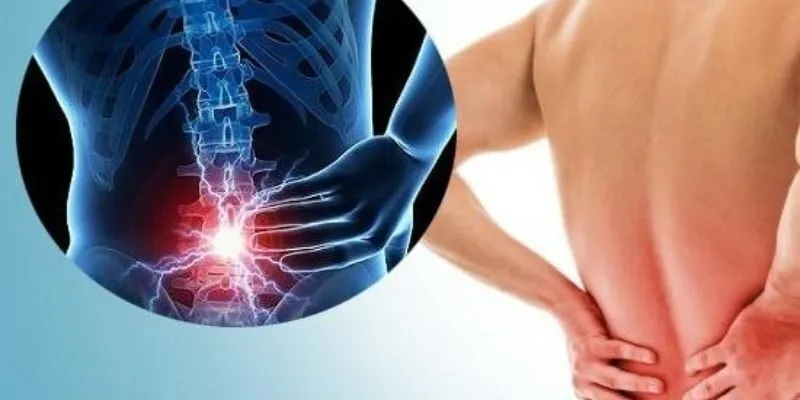 Thoát vị đĩa đệm lưng