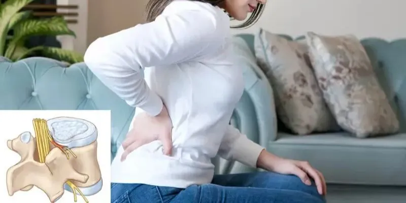 phình đĩa đệm lưng